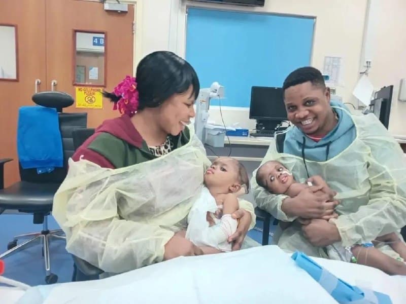 AI Helped Separate Sisters Born with a Single Skull